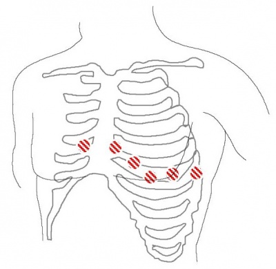 Cardiac Monitor - Protocopedia