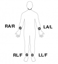 Limb Lead Placement